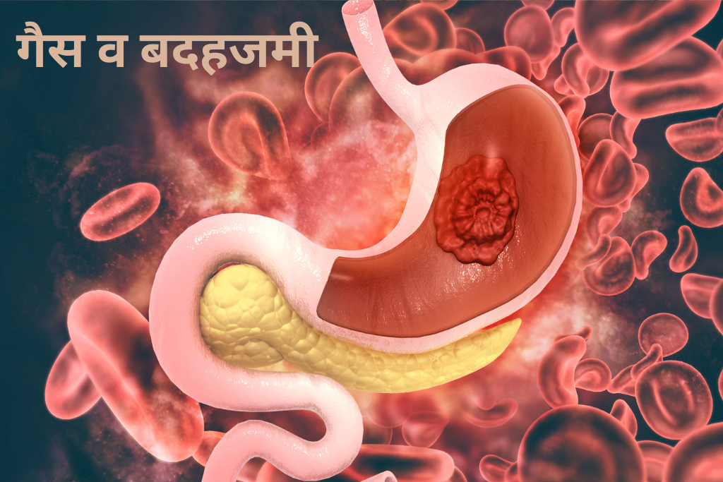 गैस व बदहजमी दूर करने के लिए