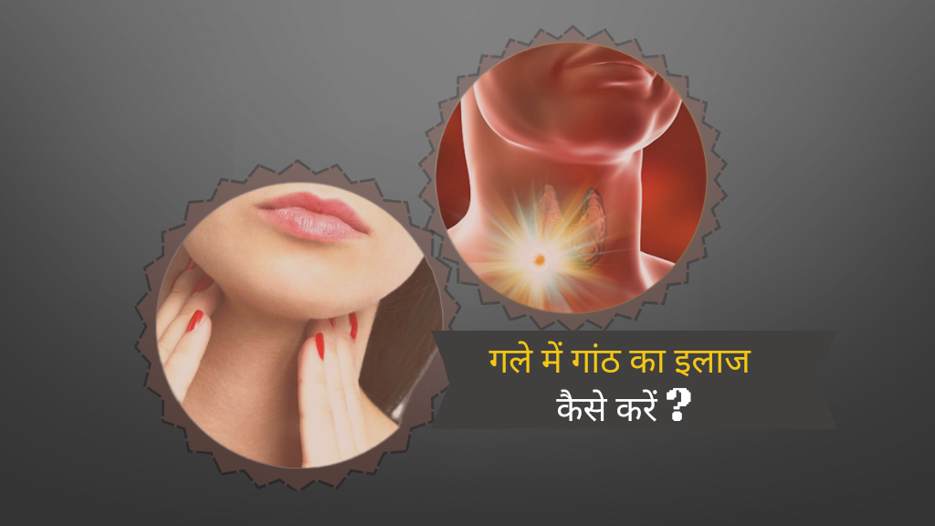 गले में गांठ क्यों होती है?: कारण, लक्षण और जानिए इसका इलाज कैसे करें?