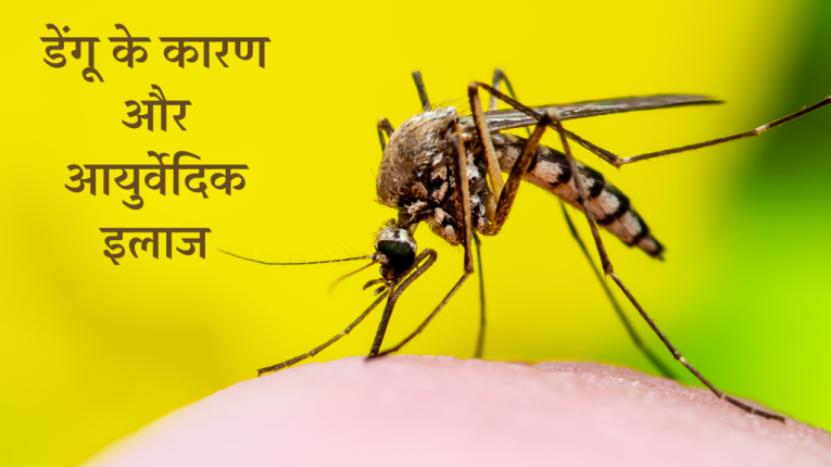 डेंगू के कारण और डेंगू का आयुर्वेदिक इलाज (Causes of Dengue and ayurvedic treatment of dengue)
